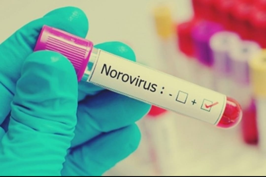 What is Norovirus, Causes, Symptoms, Infection, Treatment & More